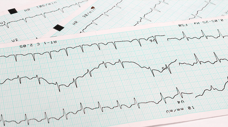 Genetic Arrhythmia Program