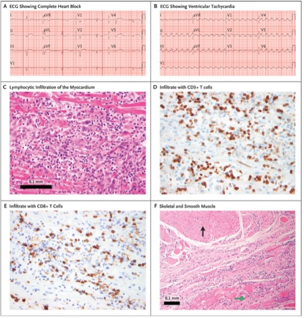 Immune checkpoint inhibitors
